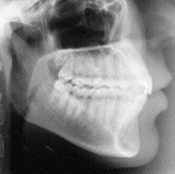 Radiologia Odontológica em Sete Lagoas